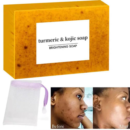 Le Savon kojic ( صابون كوجيك )